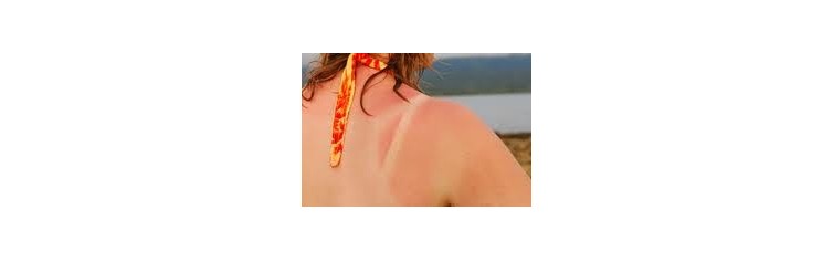 Skin, Burns, Insect Bites